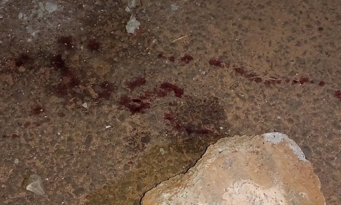 Filho é preso após agredir o pai com pedra de concreto