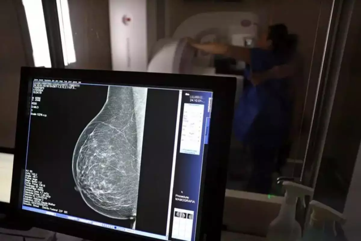 SUS garante mamografia para mulheres a partir dos 40 anos