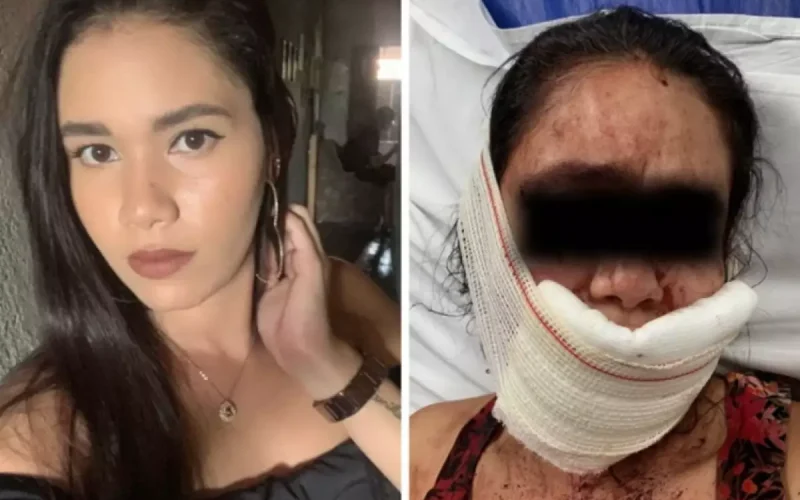Homem morde e arranca lábios da namorada porque riu dele