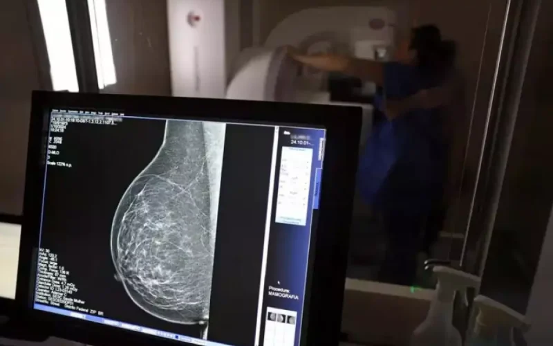 SUS garante mamografia para mulheres a partir dos 40 anos