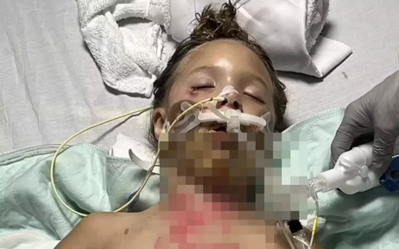 Alerta!!! Criança entra em coma após desafio do TikTok com microondas