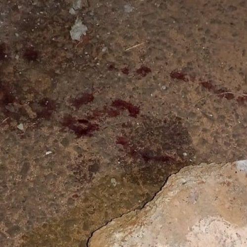 Filho é preso após agredir o pai com pedra de concreto