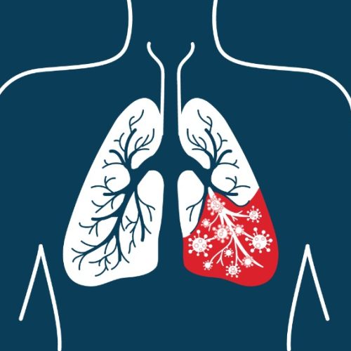 Dia Mundial da Pneumonia: Saúde de Andradina reforça alerta para prevenção e vacinação