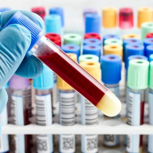 Coletas de exames laboratoriais são realizadas na zona rural de Andradina
