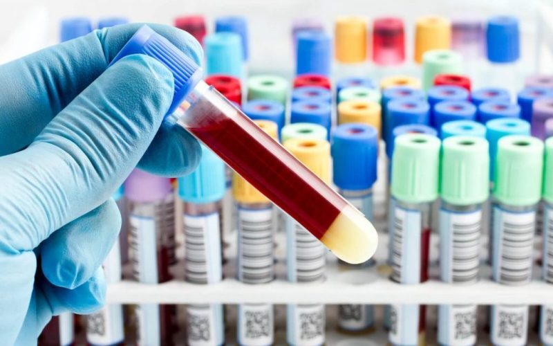 Coletas de exames laboratoriais são realizadas na zona rural de Andradina
